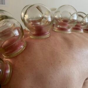 1/2 tími - viðgerð við vakumkoppum (Cupping)