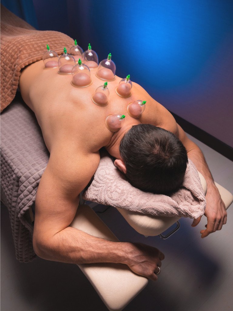 Cuppingviðgerð