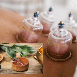 Kombiviðgerð við nálum og cupping